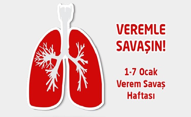 Verem Savaş Haftası Dolasıyla ilgili etkinlik